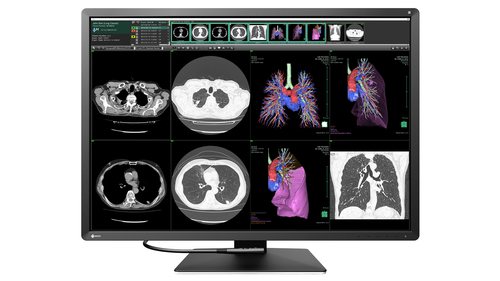 12MP EIZO RADIFORCE RX1270 31IN MAMMOGRAPHY SELFQC