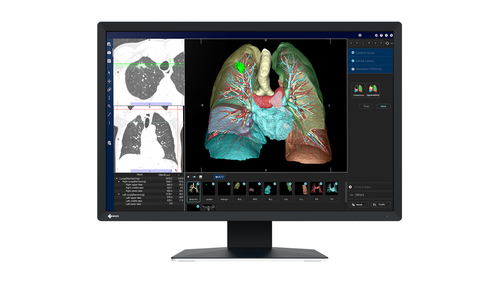 2.3MP EIZO RADIFORCE MX243W 24IN DIAGNOSTIC DISPLAY